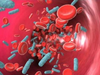 Septicemia, la enfermedad que mata más que el cáncer